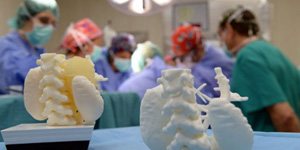 3D打印：令腫瘤根除成為現(xiàn)實！